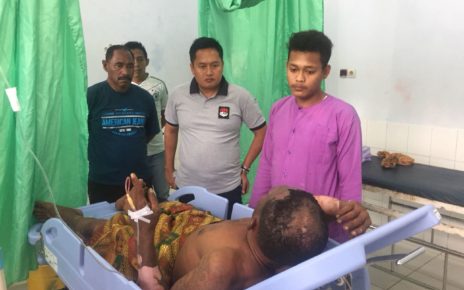 Kapolres Raja Ampat, AKBP Edy Setyanto Erning, SIK menjenguk korban kebakaran di RSUD Wisai, Minggu (22/7/2018)