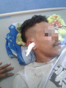 Sanusi Rahaningmas Minta Polres R4 Tangkap Pelaku Pengeroyokan