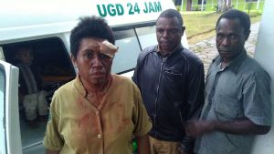 Pergoki Suami Bersama PIL Dalam Rumah, IRT Ini Dilarikan ke RS