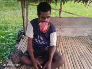 Yustus Srekeya si Pengidap Tumor Ganas Butuh Bantuan Pengobatan