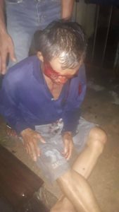 Korban Begal Dibacok Motor Dirampas, Kasat Reskrim: Pelaku Segera Ditangkap