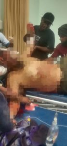 Korban Penikaman di Pelabuhan Jembatan Puri Hembuskan Nafas Terakhir
